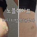 더쉐이프 | 남양주 다산피부과::복부비만주사 노블쉐이프 후기 효과 통증