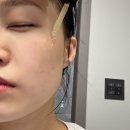 앰플추천 30대 여자친구의 칙칙한 피부를 밝혀준 바이탈포션 슈퍼 글루타씨온 찐 후기