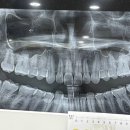 쏙쏙사랑니치과의원 이미지