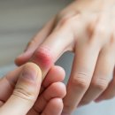 스마트폰으로 詩를 쓰다 | 마우스·스마트폰 많이 쓰는 사람, 손가락 통증 주의하세요