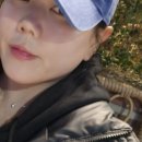 모와슈퍼 | 강남코필러 잘하는곳 신사역 슈퍼하이코 대만족 후기