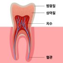고은이(e)플란트치과의원 | 신경치료, 함부로 받지 마세요