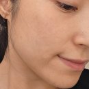 샤인엘의원 | 결혼식 한 달전, 예비신부의 피부관리 후기 feat. 안양 범계 피부과 추천