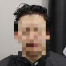 *****2037 | [대다모 포토후기] 20대 남성 2037모 모발이식 14일 후기입니다.