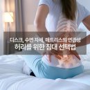 허리디스크에 좋은 매트리스 선택을 위한 정보와 추천 침대 브랜드 3곳