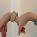 강남초이스정형외과의원 | 잠실 강남본정형외과 손목 물혹(결절종) 수술 후기