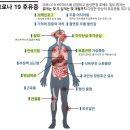 비드브레인