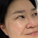 안녕 오랜만이야 숨37도 시크릿 에센스