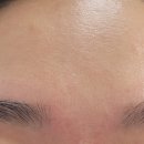 썬헤어라인 이미지