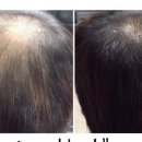 뷰티솔루션스 이미지