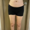 S나비의원 | 상상하면 이루어지는 다이어트의원 2회차 솔직후기