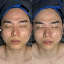 전주 효자동 고급 피부관리 &#39;리겐스킨랩&#39; 인간 탕후루 워터밤 관리 후기