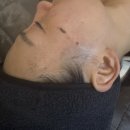 토탈랩솔루션 | 울산 신정동 피부관리 :: 코어뷰티랩 세라링 후기