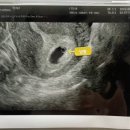 아이투비 산부인과 앞 이미지