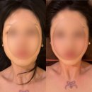 좋은 차 만들기 가양점 | 강서구 피부관리추천 | 가양역 리프리아 에스테틱 작은얼굴만들기 경락 후기