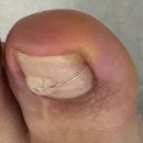 레푸스동래 | 부산 동래 내성발톱관리 무좀발관리 잘하는 곳 레푸스 동래역점 솔직 후기