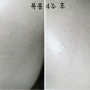 아쿠아뷰티 이미지