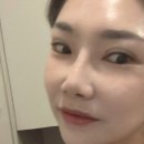 로덱스앤리버스 | 양주 옥정동피부관리 [로덱스스킨앤왁싱] 미백관리 후기