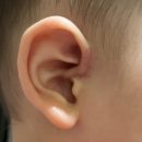 단우약국 | 어린이병원 15개월 아기 선천성 이루공, 전개이누공, 이개누공절제술 수술 후기❤️ (feat. 박무균 교수님)