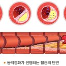 심장질환의 위험인자 이미지