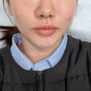 차한의원 | 강남턱관절교정 한의원 4회차 받으면서 더더 좋아져가는 후기