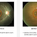 광주안과의원 이미지
