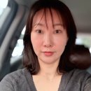 자일분당서비스(주) | 분당 서현피부과 아꼴스팟 잡티제거 &amp; 토닝 후기