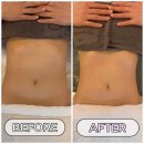 상남동129 | 창원에스테틱 상남동피부관리 잘하는 곳｜탐날에스테틱 창원점 바디관리(미레브슬리밍 복부) 후기