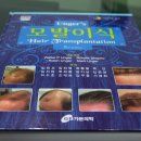 옥건헤어라인의원 이미지