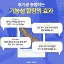 [깔창] 다이아몬드솔 기능성 깔창 코르크 깔창 족저근막염 깔창으로 추천&lt;셀막스 깔창&gt; 솔직후기