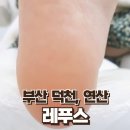 레푸스 연산점 이미지