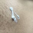 스마티언 | 임산부튼살크림 :: 리메스카 튼살크림 사용후기, 출산후에도 추천!