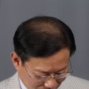 모메드솔루션 이미지