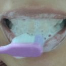 동양덴탈 | 입냄새 99%제거. 잇몸케어. 오솔림 덴탈 페이스트 후기. 자연 그대로의 송진 성분이예용!!