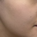 JNC화장품 | [뷰티] 여름 진정세럼 추천, JNC 피토라보 티트리 카밍 젤 세럼 솔직 후기
