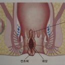 “항문” 부끄럽지만 소중한곳, 이미지