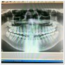 광안제일치과의원 이미지