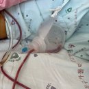 로봇 | 자궁근종 다빈치 로봇수술 후기2(입원~수술편)