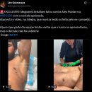 마고메드 안칼라예프 경기전 갈비뼈 부상 이미지