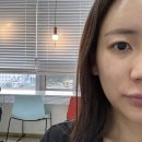 청주연세의원 | 청주 연세강연웅성형외과 예약 성공 후기｜254통 끝에 쌍수 예약 성공!