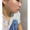 배나무한의원 | 부산 모공스킨부스터, 센텀피부과 PN주사 추천 내돈내산 후기