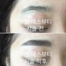 예스뷰티 네이버블로그