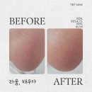 조천북로 | 발뒤꿈치 각질 제거 샵 꼼꼼한 관리 후기