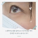 W뷰티 - 성북구 | 노원역속눈썹펌 잘하는곳 3단계 영양 케어 만족한 W 뷰티스튜디오 후기