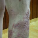 에덴벽지상사 | 천연벽지 시공 후기 - 12월 4일 권선욱 고객님(아토피 사진포함)