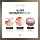 나세르의원 | 컬러 문신제거, 어두운 색이 많을수록 지우기 어려운 이유 알려드립니다｜나세르의원