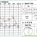 포낙보청기 남포센터 이미지