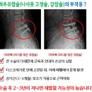 유명한 척추병원은 어디 ?? 이미지