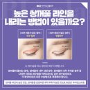 비아이오 이미지