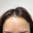 설레여짐 | 스킨부스터추천 신사피부과 셀르디엠 내돈내산후기